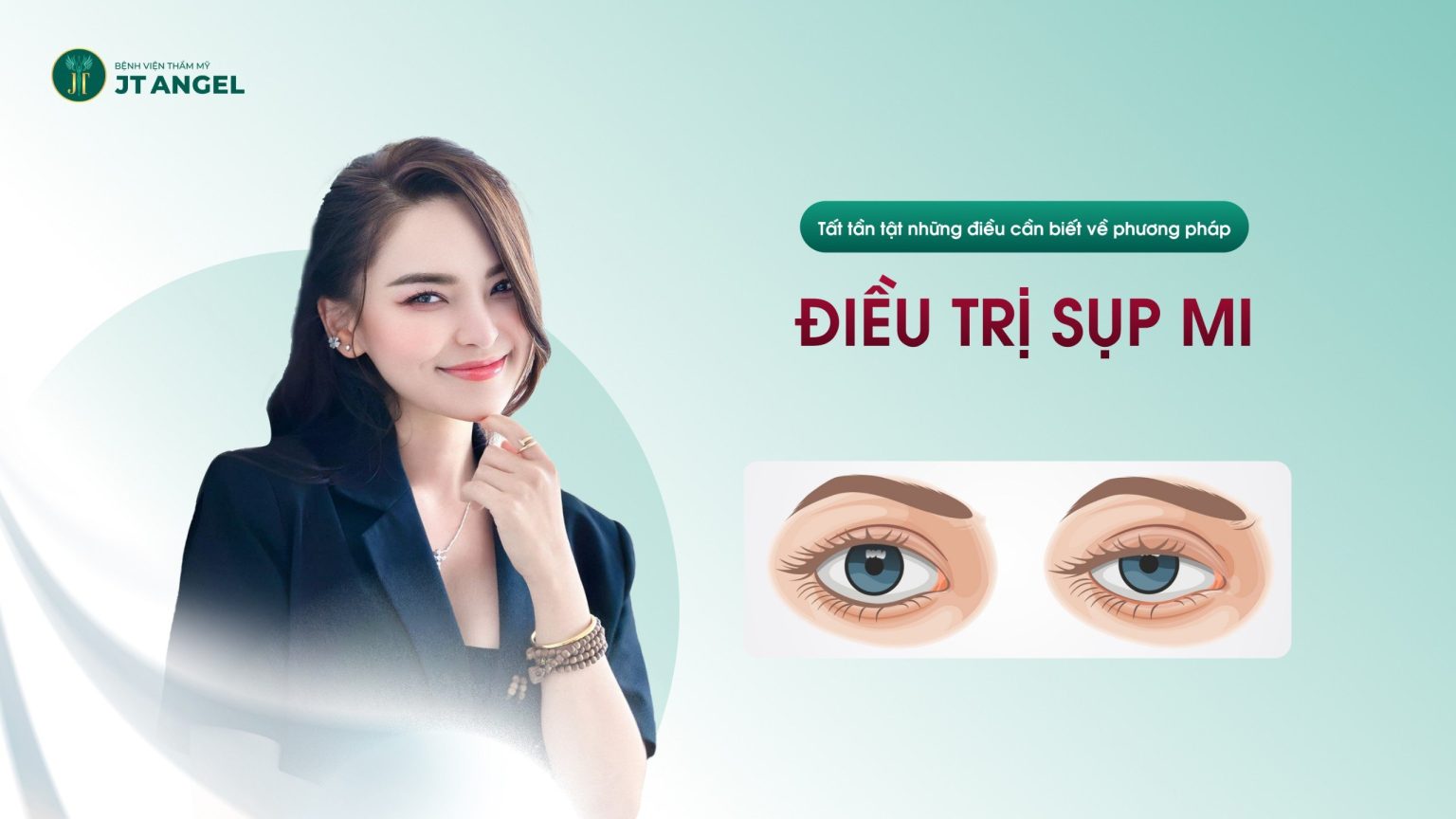 ĐIỀU TRỊ SỤP MI: TẤT TẦN TẬT NHỮNG ĐIỀU CẦN BIẾT VỀ PHƯƠNG PHÁP NÀY